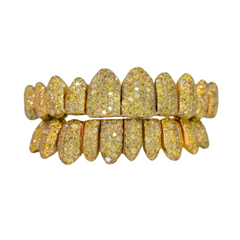 Canary Yellow VVS Moissanite Diamond Grillz