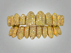 Canary Yellow VVS Moissanite Diamond Grillz