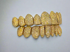 Canary Yellow VVS Moissanite Diamond Grillz
